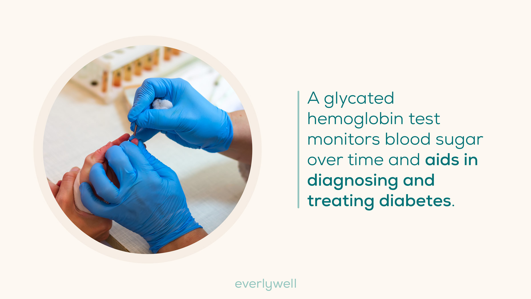 hemoglobin-test-aids-in-diagnosing-diabetes