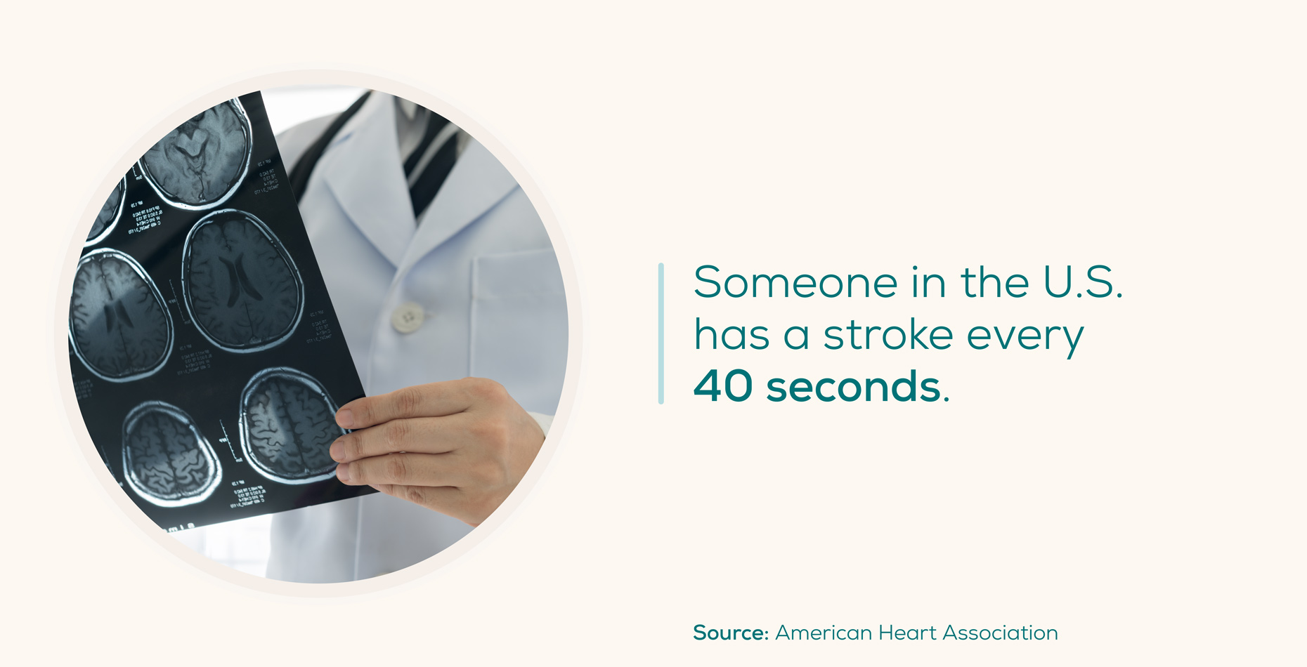 stroke-occurance-per-day