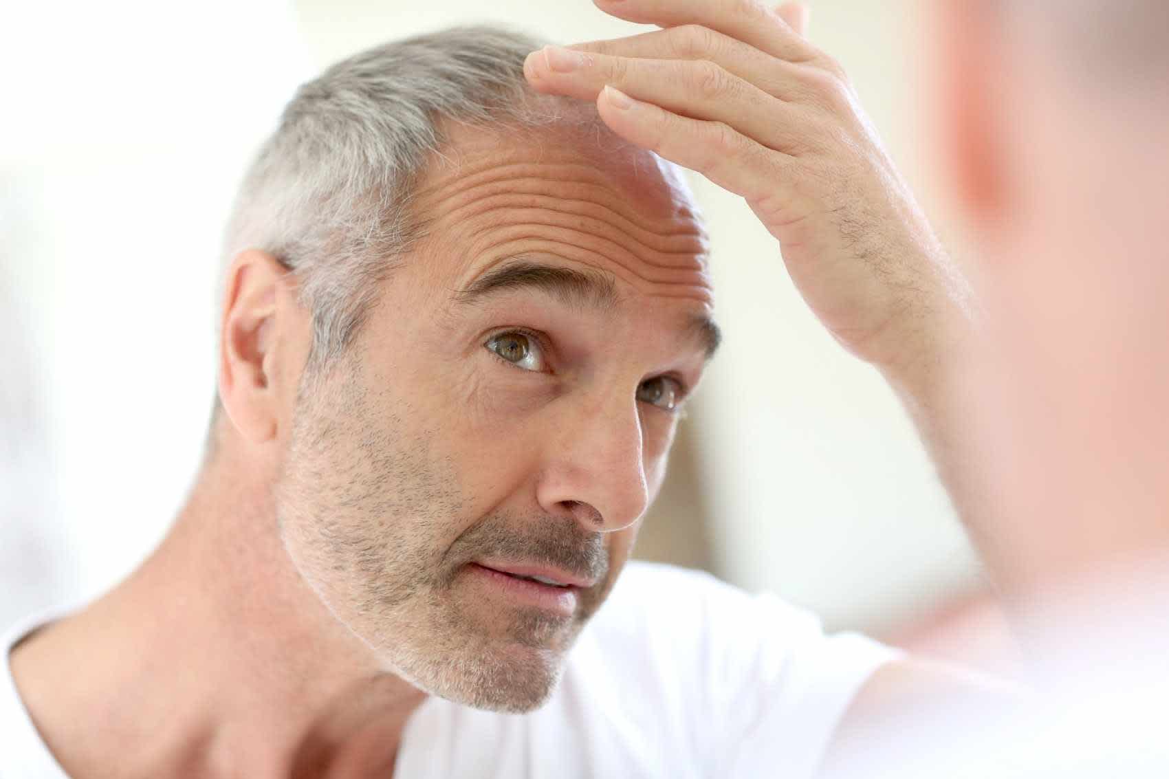 Man looking in mirror to check hair loss